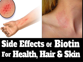 Does Pure Biotin Powder Have Any Side Effects?
